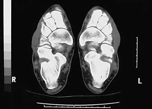 General Orthopedics Board Review 2026: High-Yield MCQs (Set 2) - Figure 64