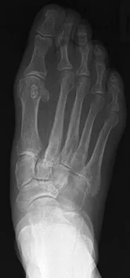 General Orthopedics Board Review 2026: High-Yield MCQs (Set 2) - Figure 66