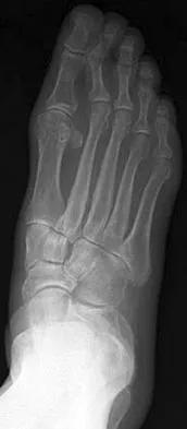 General Orthopedics Board Review 2026: High-Yield MCQs (Set 2) - Figure 67