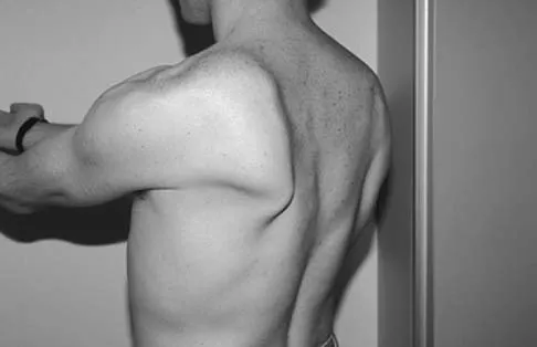 General Orthopedics Board Review 2026: High-Yield MCQs (Set 2) - Figure 72