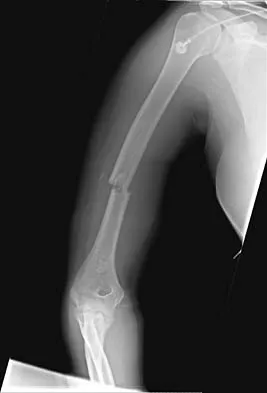 General Orthopedics Board Review 2026: High-Yield MCQs (Set 2) - Figure 77