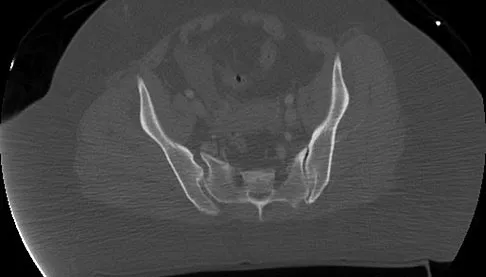 General Orthopedics Board Review 2026: High-Yield MCQs (Set 2) - Figure 79