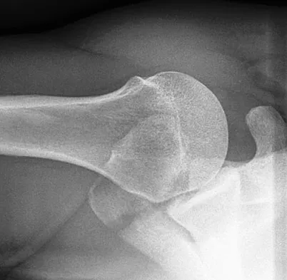 General Orthopedics Board Review 2026: High-Yield MCQs (Set 2) - Figure 8