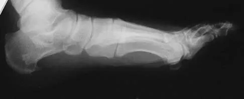 General Orthopedics Board Review 2026: High-Yield MCQs (Set 2) - Figure 81