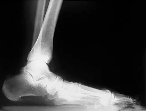 General Orthopedics Board Review 2026: High-Yield MCQs (Set 2) - Figure 83