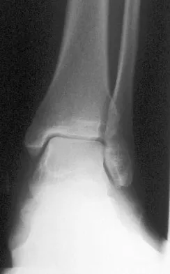 General Orthopedics Board Review 2026: High-Yield MCQs (Set 2) - Figure 86