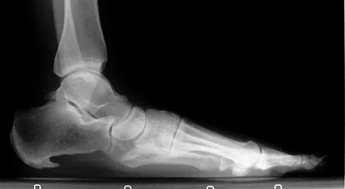 General Orthopedics Board Review 2026: High-Yield MCQs (Set 2) - Figure 88