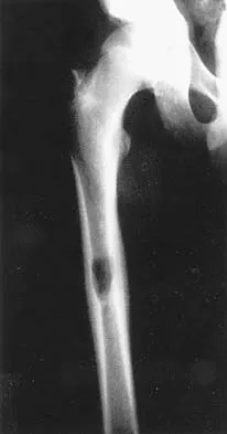 General Orthopedics Board Review 2026: High-Yield MCQs (Set 2) - Figure 92