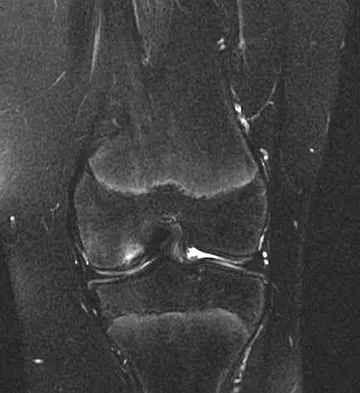 General Orthopedics Board Review 2026: High-Yield MCQs (Set 2) - Figure 95
