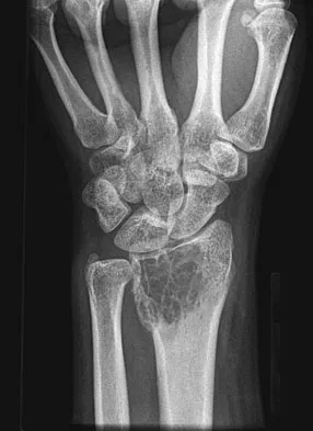 General Orthopedics Board Review 2026: High-Yield MCQs (Set 2) - Figure 98