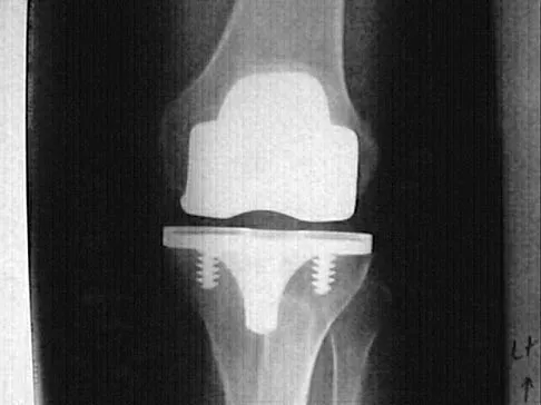 General Orthopedics Board Review 2026: High-Yield MCQs (Set 20) - Figure 11