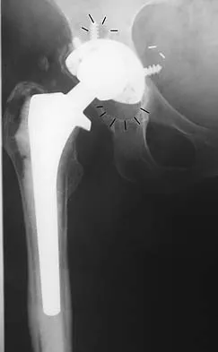 General Orthopedics Board Review 2026: High-Yield MCQs (Set 20) - Figure 12