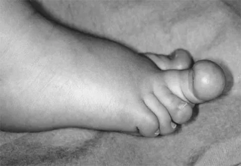 General Orthopedics Board Review 2026: High-Yield MCQs (Set 20) - Figure 15