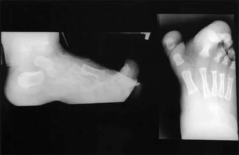 General Orthopedics Board Review 2026: High-Yield MCQs (Set 20) - Figure 16
