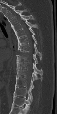 General Orthopedics Board Review 2026: High-Yield MCQs (Set 20) - Figure 17