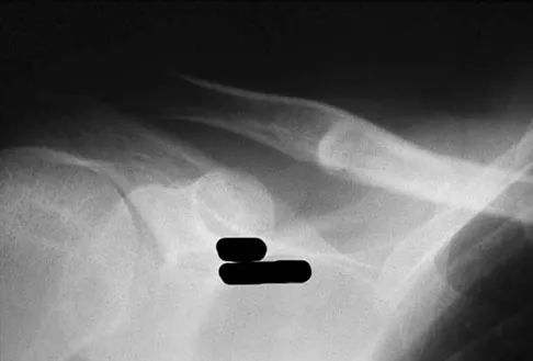 General Orthopedics Board Review 2026: High-Yield MCQs (Set 20) - Figure 21