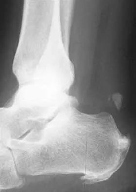 General Orthopedics Board Review 2026: High-Yield MCQs (Set 20) - Figure 27