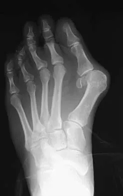 General Orthopedics Board Review 2026: High-Yield MCQs (Set 20) - Figure 36