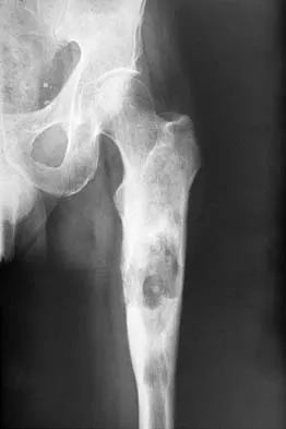 General Orthopedics Board Review 2026: High-Yield MCQs (Set 20) - Figure 37