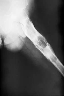 General Orthopedics Board Review 2026: High-Yield MCQs (Set 20) - Figure 38