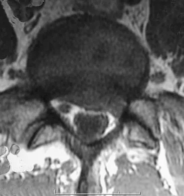 General Orthopedics Board Review 2026: High-Yield MCQs (Set 20) - Figure 39