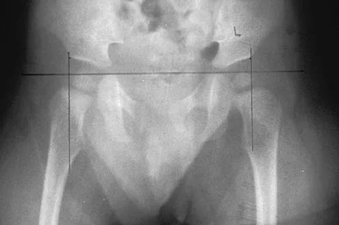 General Orthopedics Board Review 2026: High-Yield MCQs (Set 20) - Figure 41