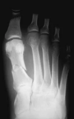 General Orthopedics Board Review 2026: High-Yield MCQs (Set 20) - Figure 47