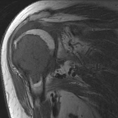 General Orthopedics Board Review 2026: High-Yield MCQs (Set 20) - Figure 53