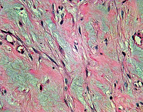 General Orthopedics Board Review 2026: High-Yield MCQs (Set 20) - Figure 58