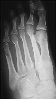 General Orthopedics Board Review 2026: High-Yield MCQs (Set 20) - Figure 63