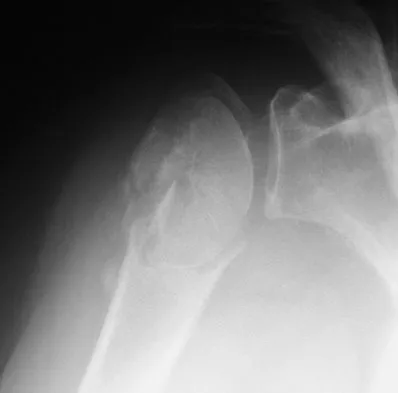 General Orthopedics Board Review 2026: High-Yield MCQs (Set 20) - Figure 67