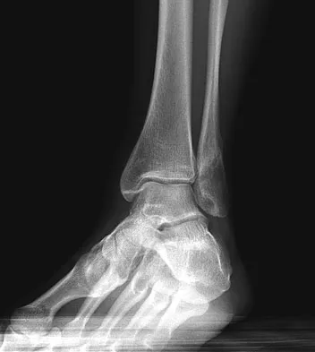 General Orthopedics Board Review 2026: High-Yield MCQs (Set 20) - Figure 71