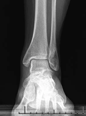 General Orthopedics Board Review 2026: High-Yield MCQs (Set 20) - Figure 72