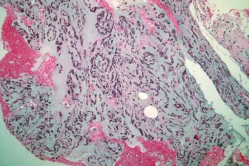 General Orthopedics Board Review 2026: High-Yield MCQs (Set 20) - Figure 75