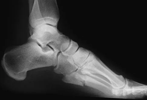 General Orthopedics Board Review 2026: High-Yield MCQs (Set 20) - Figure 79