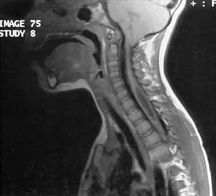 General Orthopedics Board Review 2026: High-Yield MCQs (Set 20) - Figure 81