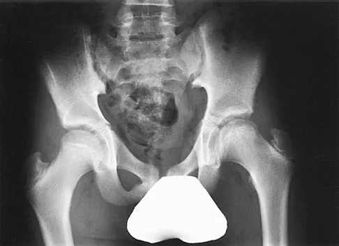 General Orthopedics Board Review 2026: High-Yield MCQs (Set 20) - Figure 82