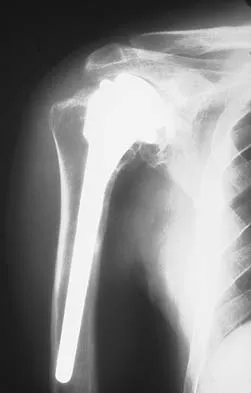 General Orthopedics Board Review 2026: High-Yield MCQs (Set 20) - Figure 85