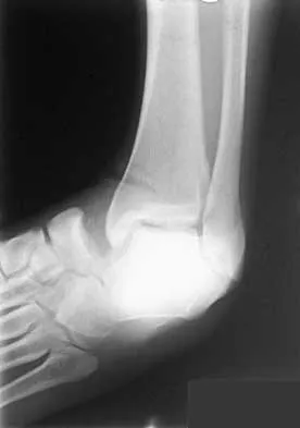 General Orthopedics Board Review 2026: High-Yield MCQs (Set 20) - Figure 87