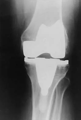 General Orthopedics 2026 Practice Questions: Set 3 (Solved) - Figure 101