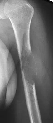 General Orthopedics 2026 Practice Questions: Set 3 (Solved) - Figure 106