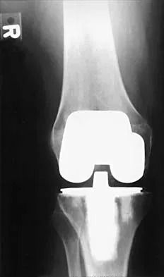 General Orthopedics 2026 Practice Questions: Set 3 (Solved) - Figure 107