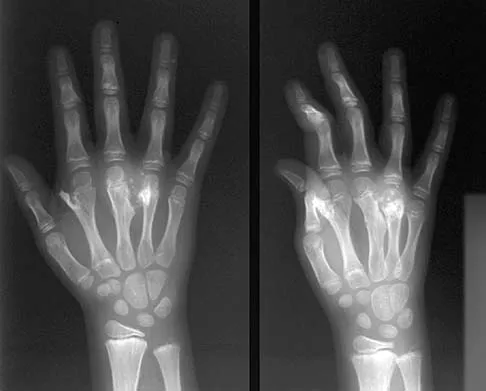 General Orthopedics 2026 Practice Questions: Set 3 (Solved) - Figure 109