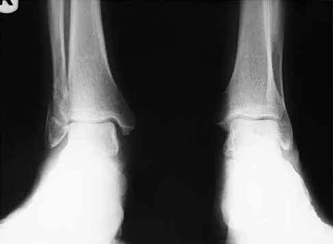 General Orthopedics 2026 Practice Questions: Set 3 (Solved) - Figure 11