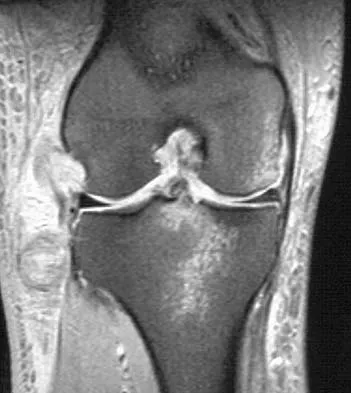 General Orthopedics 2026 Practice Questions: Set 3 (Solved) - Figure 113