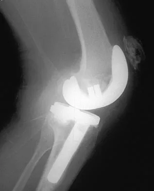 General Orthopedics 2026 Practice Questions: Set 3 (Solved) - Figure 115