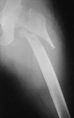 General Orthopedics 2026 Practice Questions: Set 3 (Solved) - Figure 12