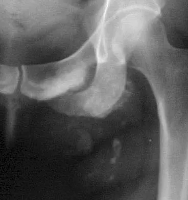 General Orthopedics 2026 Practice Questions: Set 3 (Solved) - Figure 120