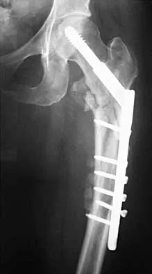 General Orthopedics 2026 Practice Questions: Set 3 (Solved) - Figure 15