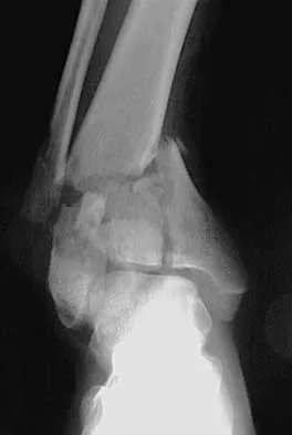 General Orthopedics 2026 Practice Questions: Set 3 (Solved) - Figure 18